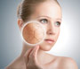 Starzenie się skóry. Metody zapobiegania oraz pielęgnacja skóry dojrzałej cz.1